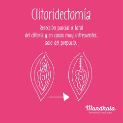 Clitoridectomía
